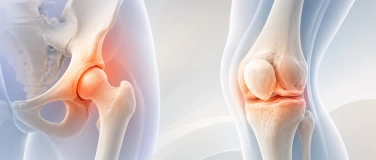 Event-Image for 'Knie- und H&uuml;ftarthrose: Was hilft wirklich?'