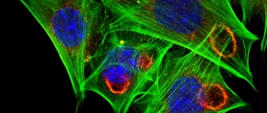 Event-Image for 'LIFEum3: Die leuchtende Tiefsee'